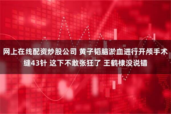 网上在线配资炒股公司 黄子韬脑淤血进行开颅手术缝43针 这下不敢张狂了 王鹤棣没说错